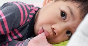 Read more about the article A Complete Guide to Thumb Sucking Appliances